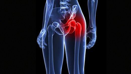 Kasık fıtığı nedir nasıl olur seks yapabilirler mi? - Resim: 0